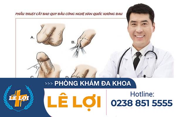 Các phương pháp cắt bao quy đầu.