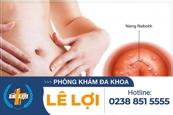Nang Naboth Cổ Tử Cung Do Đâu Và Phương Pháp Điều Trị Hiệu Quả
