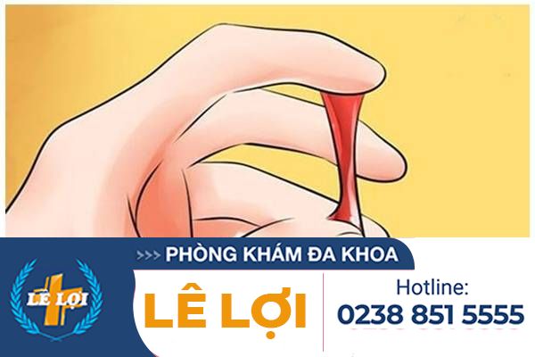 Cách Hỗ Trợ Điều Trị Khí Hư Ra Nhiều Tại Tp. Vinh Dành Cho Phái Đẹp