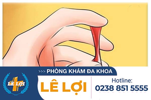 Khí Hư Màu Đỏ: Dấu Hiệu Bệnh Lý Nguy Hiểm Ở Nữ Giới