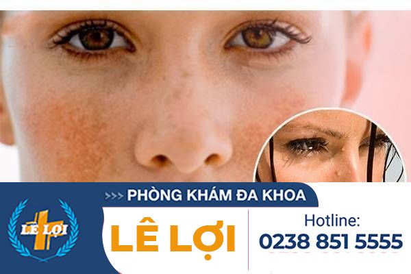 Không Có Kinh, Tắc Kinh Nguyệt Phải Làm Sao?