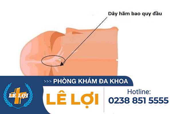 Đứt dây hãm bao quy đầu cần phải làm gì ?
