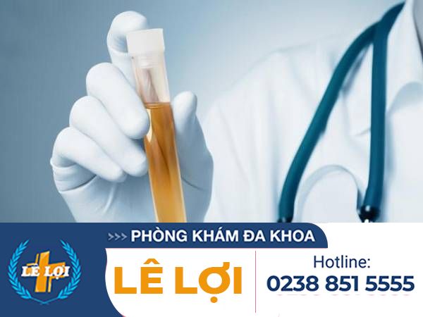 Những điều cần biết về nhiễm khuẩn đường tiểu