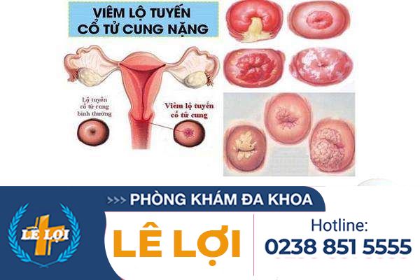 tac-hai-rong-kinh-la-gi