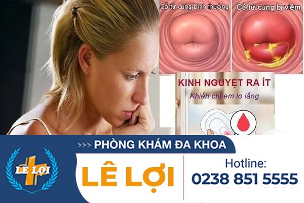 Kinh Nguyệt Ra Ít Hơn Bình Thường Là Bệnh Gì?