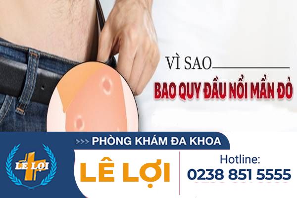 Quy đầu nổi mẫn đỏ ảnh hưởng đến sức khỏe như thế nào ?