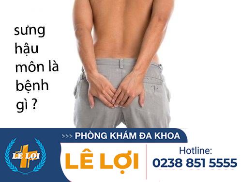 Sưng hậu môn là triệu chứng bệnh gì ?