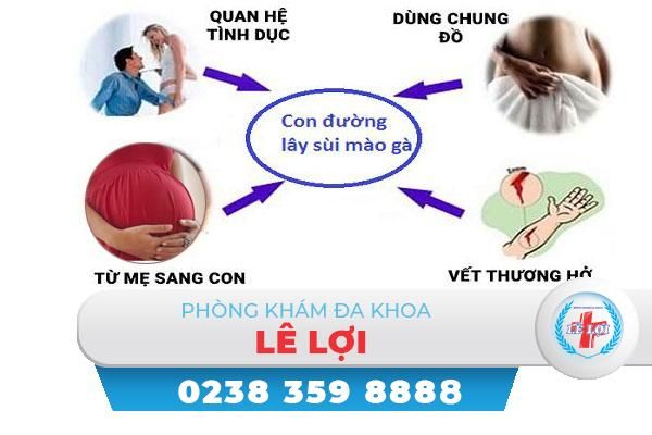 Sùi mào gà lây qua đường nào ?