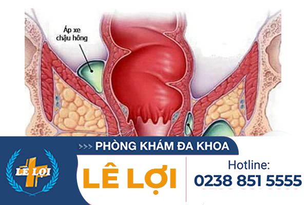 dau-hieu-ap-xe-hau-mon