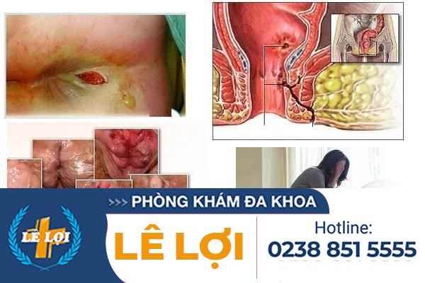 hau-qua-chay-dich-nhay