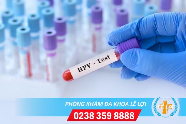 Những phương pháp xét nghiệm HPV hiện nay