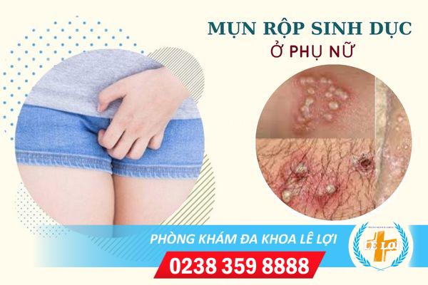 mun-rop-sinh-duc-o-phu-nu