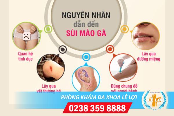 Nguyên nhân sùi mào gà