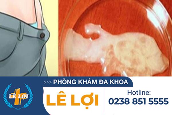 Những bất thường ở tinh trùng