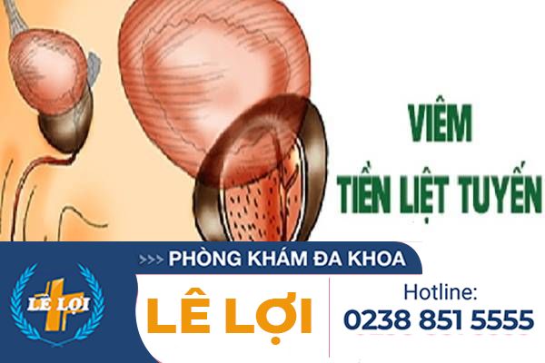 Viêm tiền liệt tuyến là bệnh gì ?