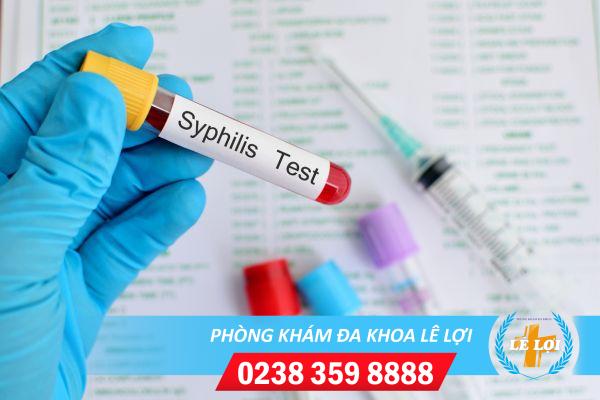 Các cách xét nghiệm giang mai hiện nay
