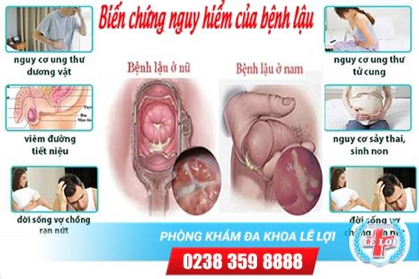 Bệnh lậu có nguy hiểm không ?