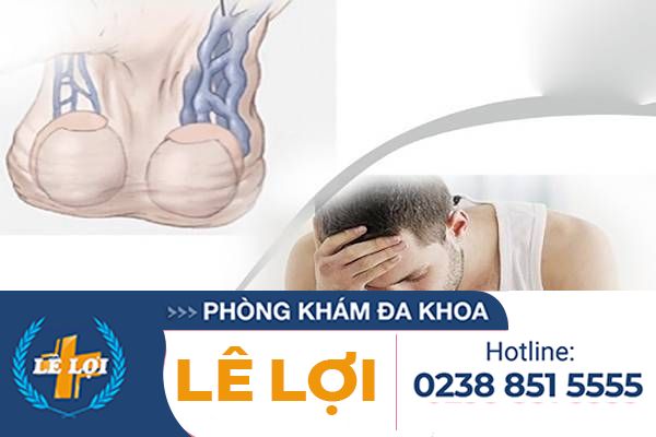 Hỗ trợ điều trị giãn mạch thừng tinh tại Đa Khoa Lê Lợi