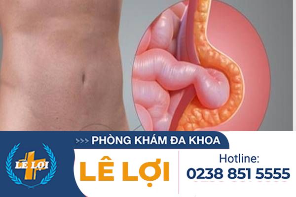 Hạch vùng bẹn và háng phải làm như thế nào ?
