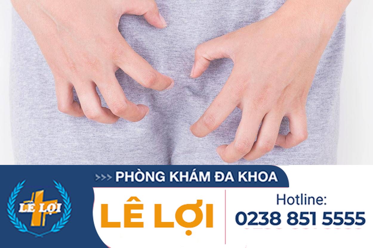 Phương pháp hỗ trợ điều trị đau rát vùng bẹn và háng hiệu quả