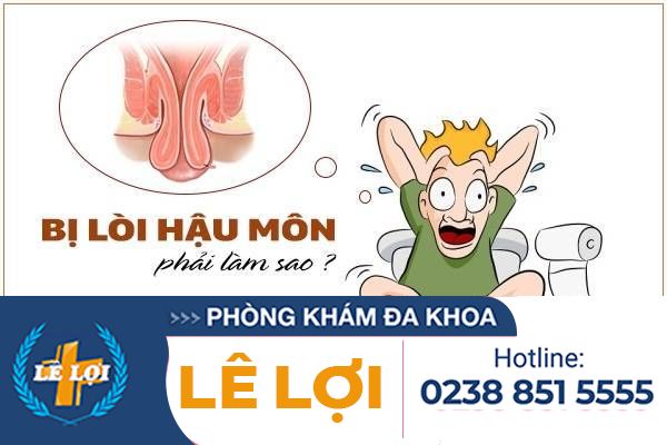 Bị lòi hậu môn phải làm sao?