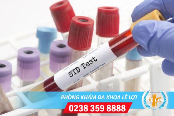 Xét nghiệm bệnh xã hội ở đâu thì uy tín ?