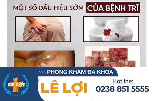 bieu-hien-cua-benh-tri