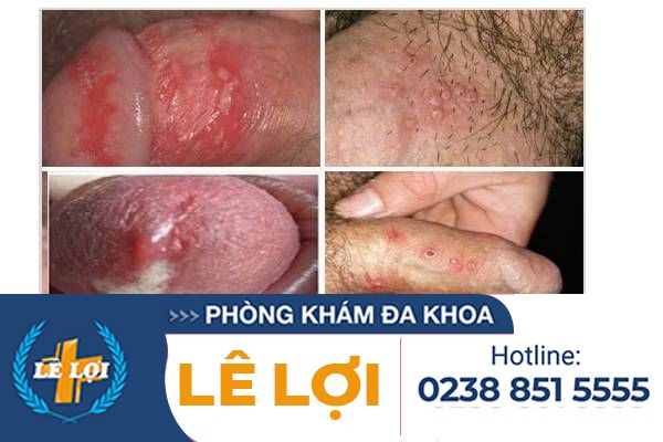 cac-benh-nam-khoa-thuong-gap