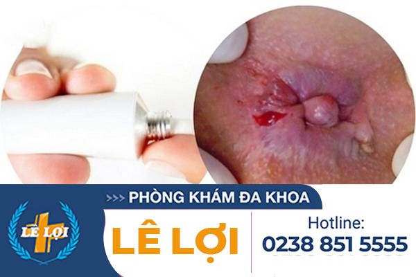 cach-lam-teo-bui-tri-hieu-qua