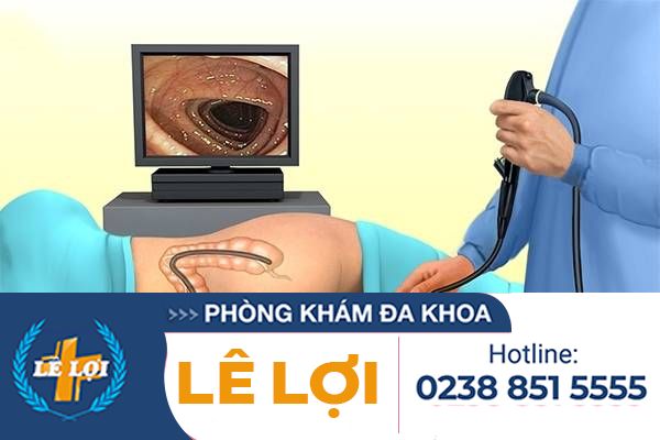 Nội soi hậu môn ở đâu uy tín?
