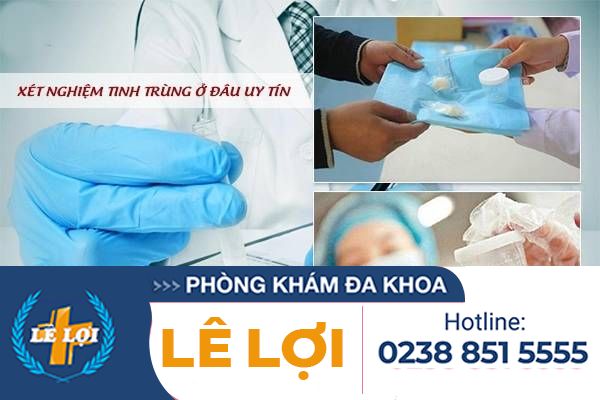 Xét nghiệm tinh trùng ở đâu uy tín