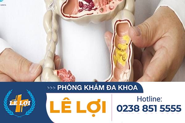 5 bệnh lý hậu môn trực tràng phổ biến hiện nay