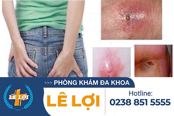 Ap-xe-tang-sinh-mon-gay-dau-rat-kho-chiu-khi-di-dai-tine