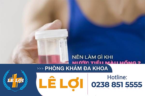Nên làm gì khi nước tiểu màu hồng?