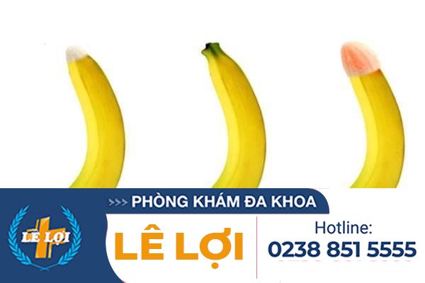 Những biểu hiện viêm nhiễm do chứng dài hẹp bao quy đầu ở nam giới