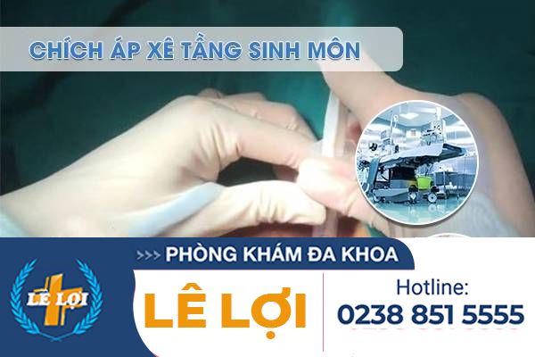 Phương pháp loại bỏ ap-xe tầng sinh môn - Liệu trình một lần duy nhất