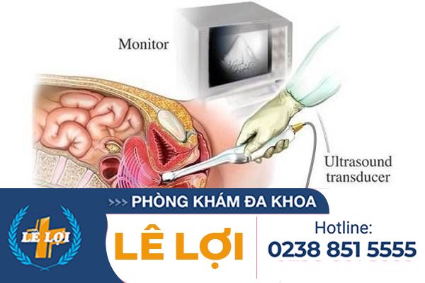 Địa chỉ thông tắc vòi trứng uy tín tại Nghệ An