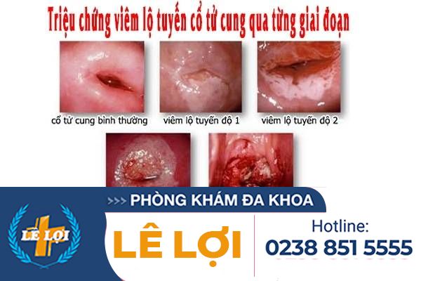 rong-kinh-canh-bao-nhieu-benh-ly-nguy-hiem