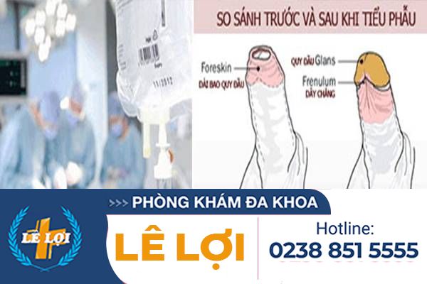 Không lột bao quy đầu có sao không?
