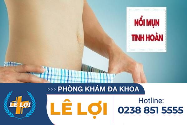 Nổi mụn ở tinh hoàn là dấu hiệu bệnh gì và cách chữa trị