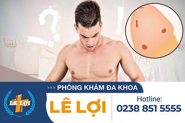 Dương vật nổi mụn đỏ là bị bệnh gì? Cách chữa trị như thế nào hiệu quả?