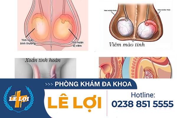 Sưng tinh hoàn là triệu chứng bệnh gì có nguy hiểm không?