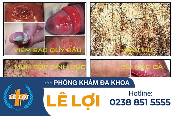 nhung-benh-gay-ngua-duong-vat