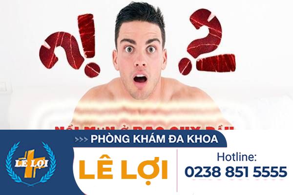 Nổi mụn ở bao quy đầu là bị bệnh gì?