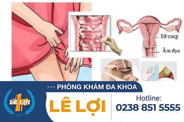 dau-hieu-viem-am-dao