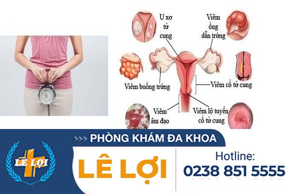 Chậm kinh là triệu chứng của bệnh gì?