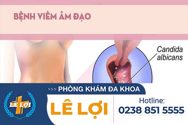 Dấu hiệu nhận biết bị viêm âm đạo