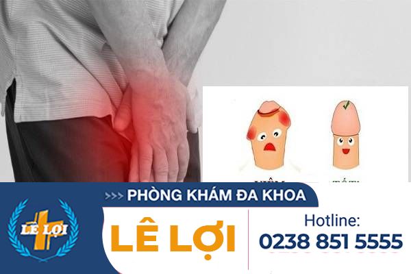 Nguyên nhân nổi mụn ở lỗ sáo và cách điều trị hiệu quả