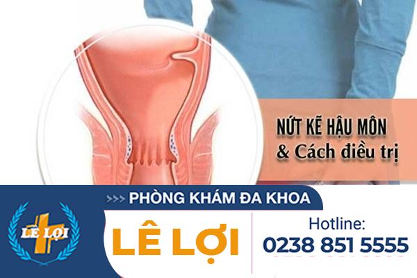 Biểu hiện của nứt kẽ hậu môn và cách điều trị hiệu quả