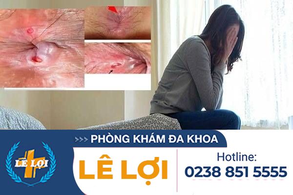 tac-hai-nut-ke-hau-mon